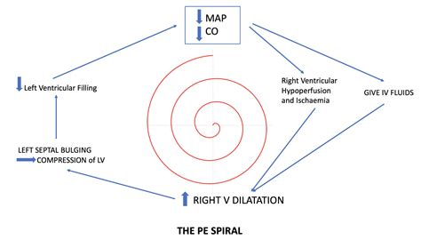 rv lv ratio pe|rv spiral of death.